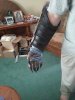 RH arm 3.jpg RH arm 3.jpg
