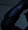 ddelbow.forearm.jpg ddelbow.forearm.jpg